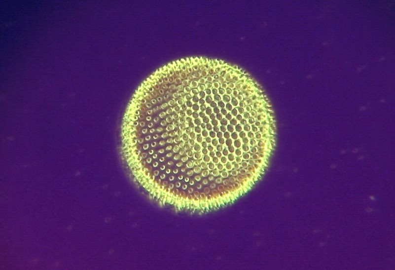 Diatom with purple center stop and yellow annulus ring