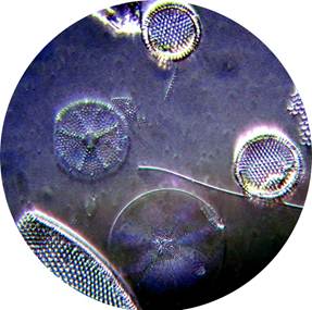 Diatoms using Rheinberg Filter and DIC Filter
