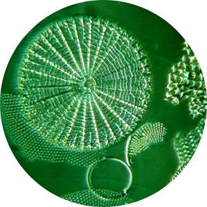 Diatoms using Rheinberg Filter and DIC Filter